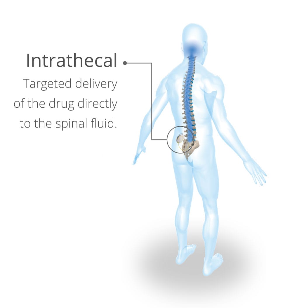 lioresal-intrathecal-baclofen-injection-lioresal-intrathecal