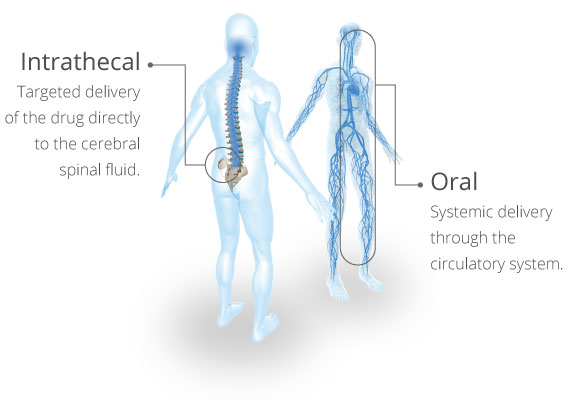 Is Lioresal Intrathecal Right for You Lioresal Intrathecal