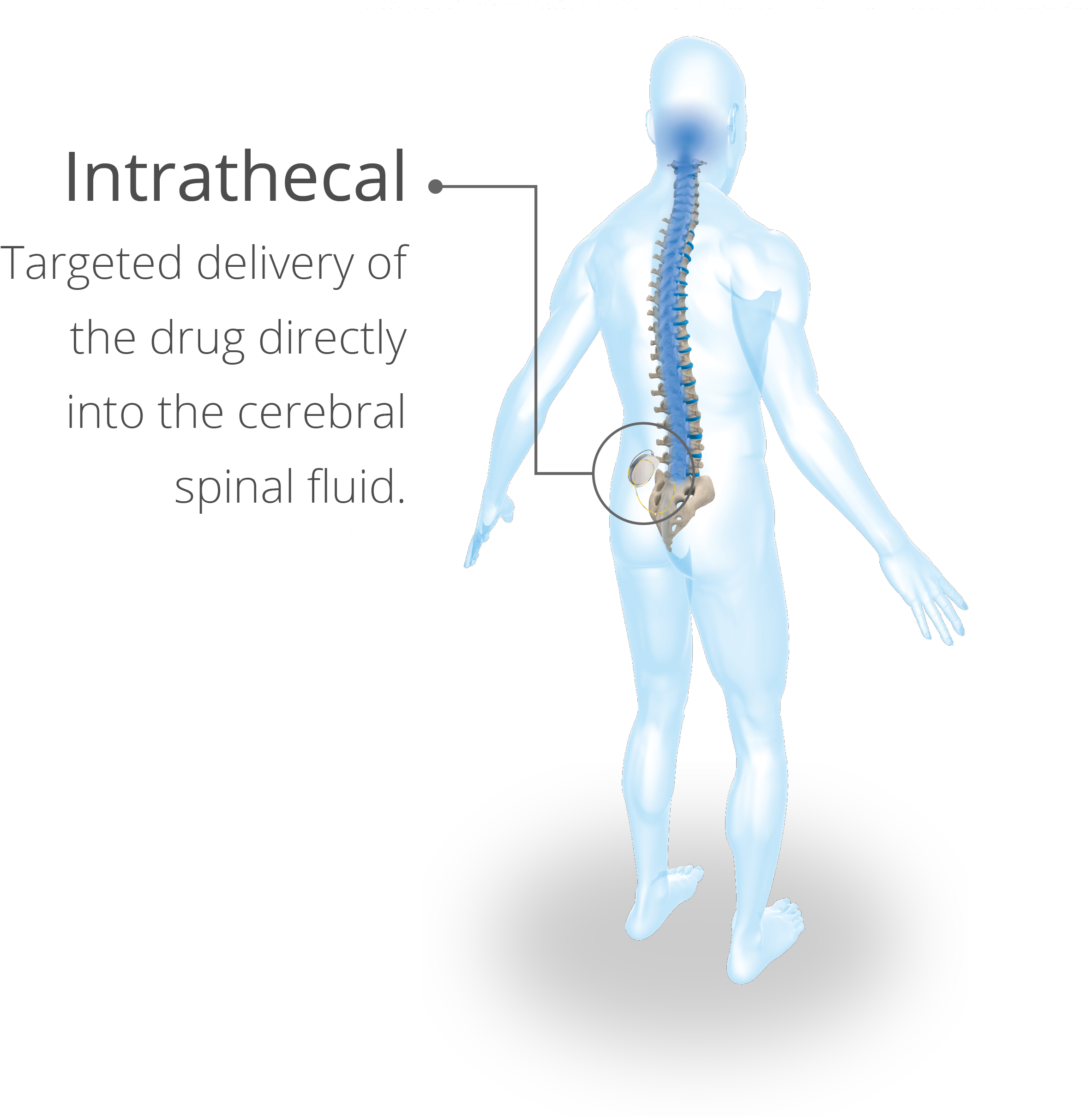 LIORESAL INTRATHECAL baclofen injection Lioresal Intrathecal